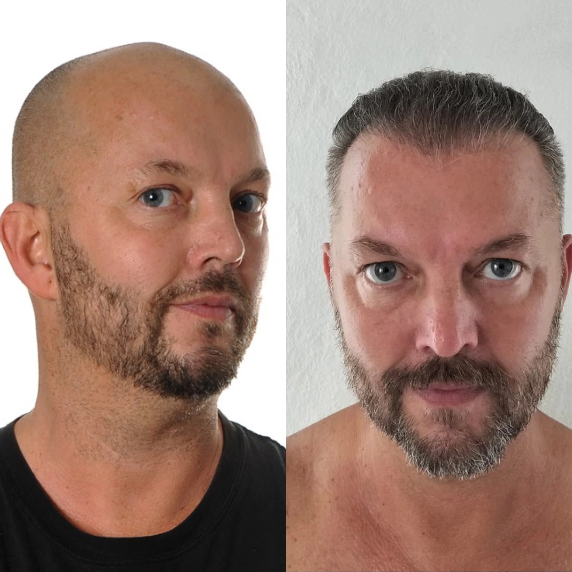 Prima & Dopo Riccarco (metodo T.A.I.)