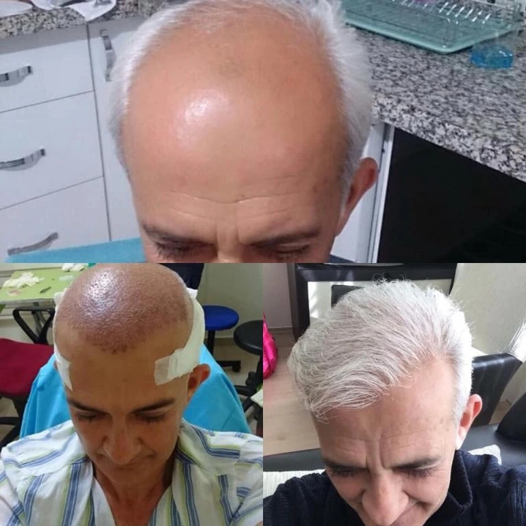 Carmelo Prima & Dopo (metodo T.A.I:)